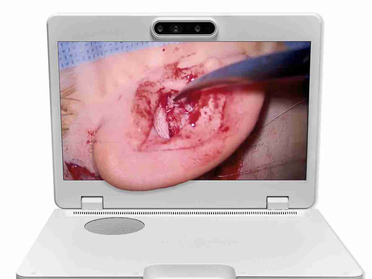 达擎之＂Heads-up 3D显微手术显示系统＂，，，，整合4K裸眼3D显示及眼球追踪系统，，，具备快速追踪人眼移动位置功能，，减轻医师长时间维持固定姿势的负担，，让医师能有更宽广清晰的3D立体视野及更舒适的姿势来执行手术。。。